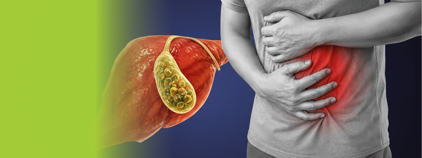 Gallbladder Stones Treatment without Surgery