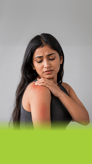Summer Skin Rash Treatment : A Complete Guide